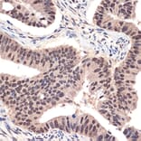 Immunohistochemistry - Anti-EHMT2/G9A Antibody [ARC2470] (A305253) - Antibodies.com