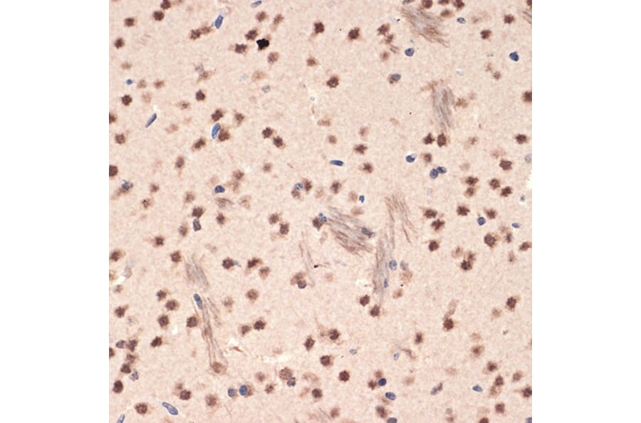 Immunohistochemistry - Anti-EHMT2/G9A Antibody [ARC2470] (A305253) - Antibodies.com