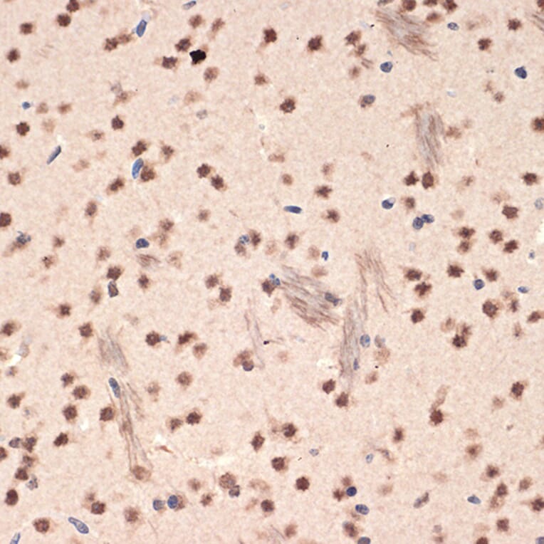 Immunohistochemistry - Anti-EHMT2/G9A Antibody [ARC2470] (A305253) - Antibodies.com