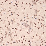 Immunohistochemistry - Anti-EHMT2/G9A Antibody [ARC2470] (A305253) - Antibodies.com