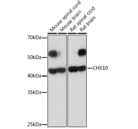 Western Blot - Anti-CHX10 Antibody [ARC2354] (A305254) - Antibodies.com