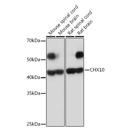 Western Blot - Anti-CHX10 Antibody [ARC2354] (A305254) - Antibodies.com