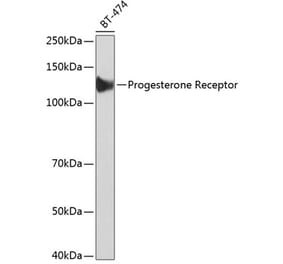 Western Blot - Anti-Progesterone Receptor Antibody [ARC51400] (A305255) - Antibodies.com