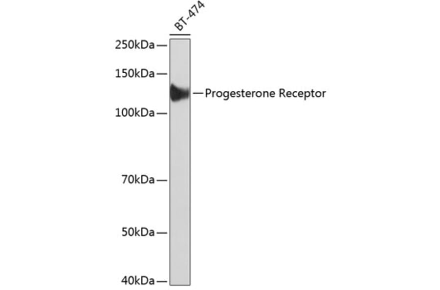 Western Blot - Anti-Progesterone Receptor Antibody [ARC51400] (A305255) - Antibodies.com