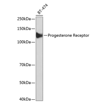 Western Blot - Anti-Progesterone Receptor Antibody [ARC51400] (A305255) - Antibodies.com