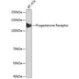 Western Blot - Anti-Progesterone Receptor Antibody [ARC51400] (A305255) - Antibodies.com