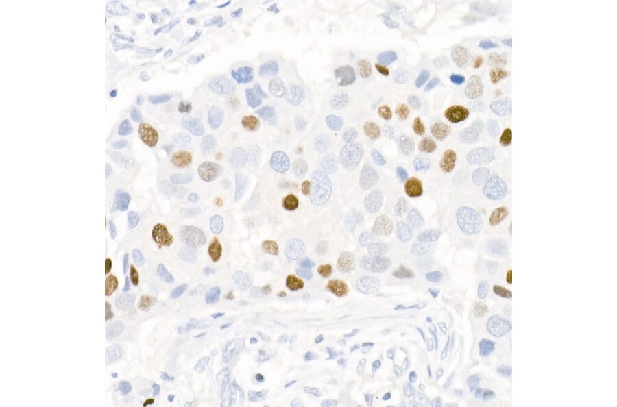 Immunohistochemistry - Anti-Progesterone Receptor Antibody [ARC51400] (A305255) - Antibodies.com