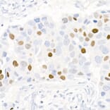 Immunohistochemistry - Anti-Progesterone Receptor Antibody [ARC51400] (A305255) - Antibodies.com