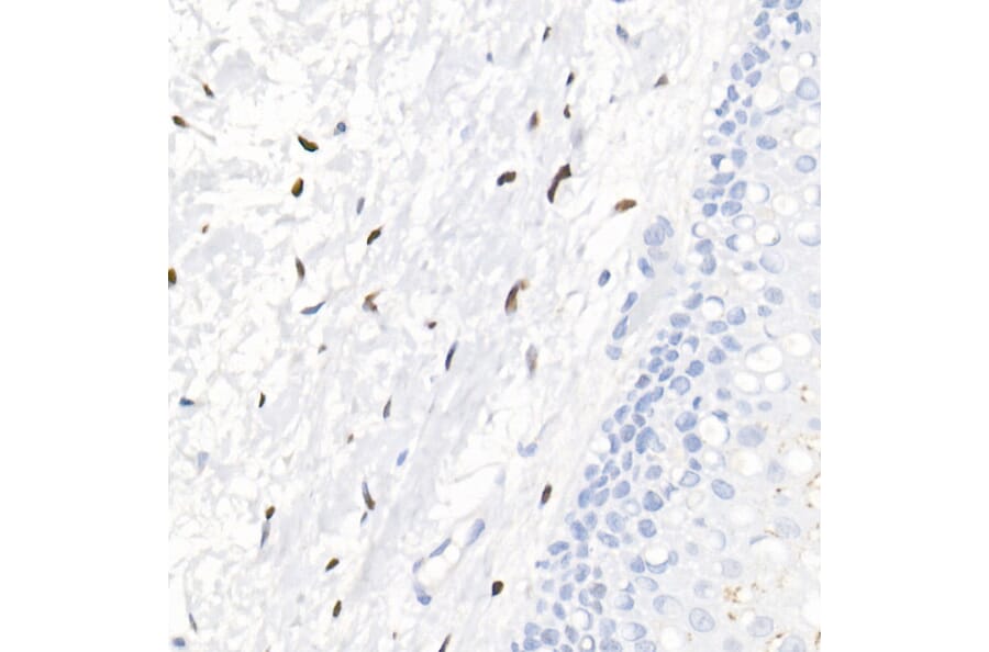 Immunohistochemistry - Anti-Progesterone Receptor Antibody [ARC51400] (A305255) - Antibodies.com