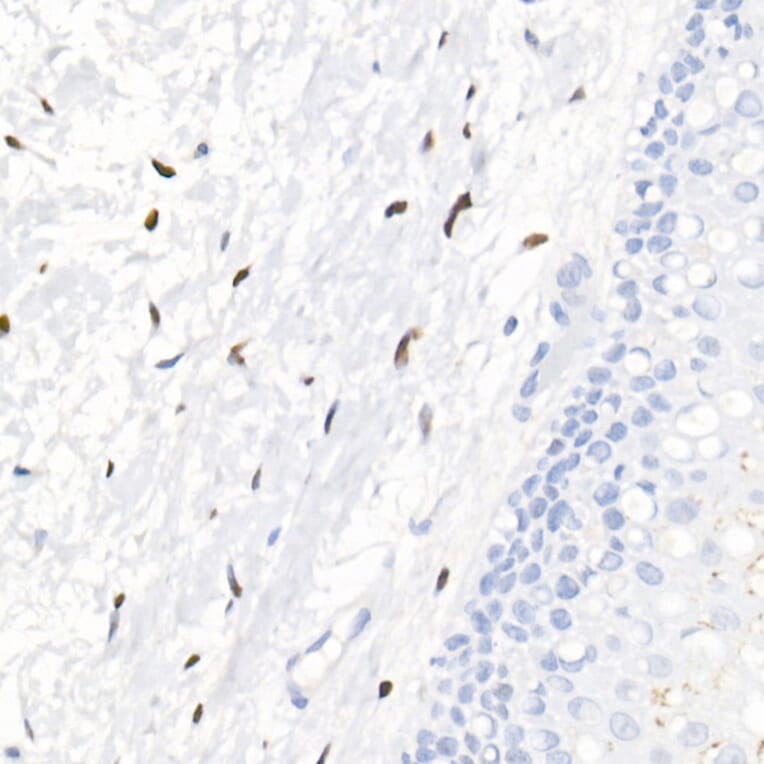 Immunohistochemistry - Anti-Progesterone Receptor Antibody [ARC51400] (A305255) - Antibodies.com