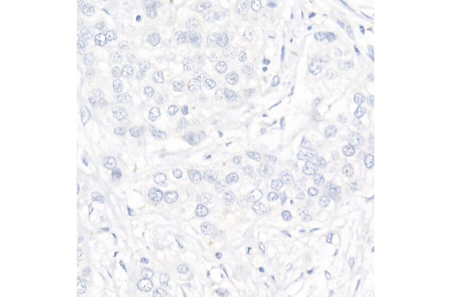 Immunohistochemistry - Anti-Progesterone Receptor Antibody [ARC51400] (A305255) - Antibodies.com