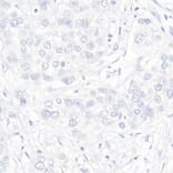 Immunohistochemistry - Anti-Progesterone Receptor Antibody [ARC51400] (A305255) - Antibodies.com