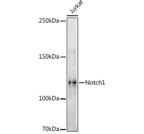 Western Blot - Anti-Notch1 Antibody (A305257) - Antibodies.com
