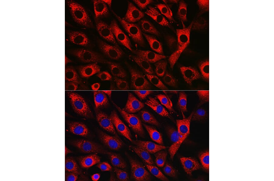 Immunofluorescence - Anti-UFL1 Antibody (A305259) - Antibodies.com