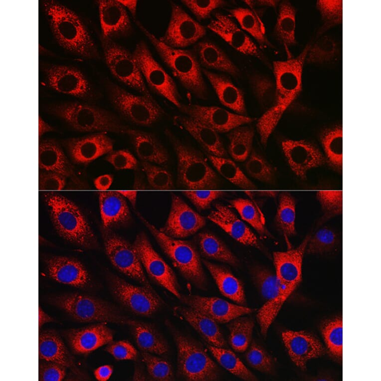 Immunofluorescence - Anti-UFL1 Antibody (A305259) - Antibodies.com