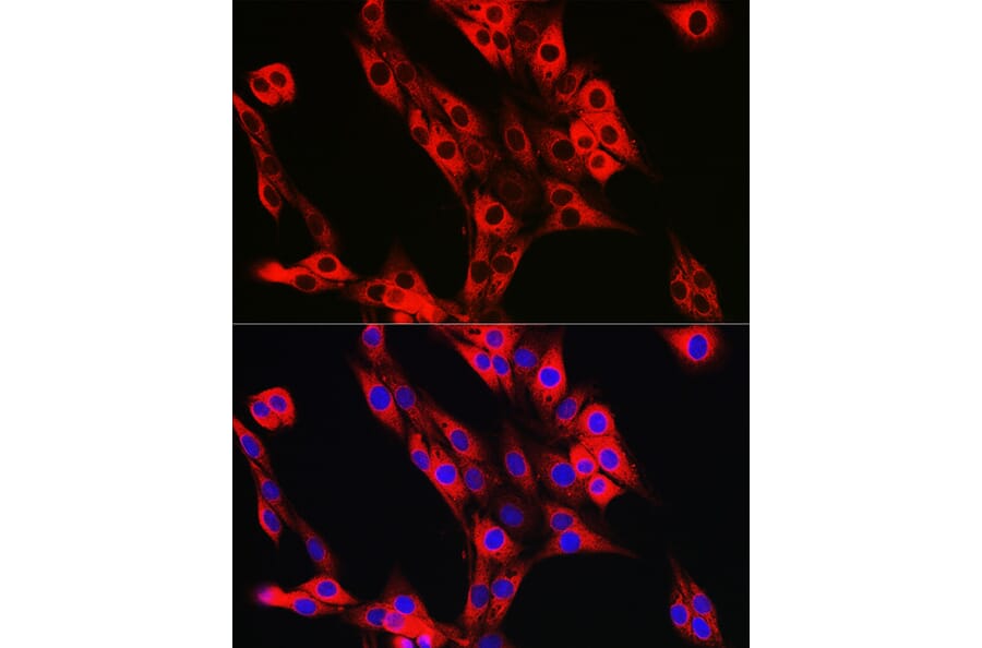 Immunofluorescence - Anti-UFL1 Antibody (A305259) - Antibodies.com