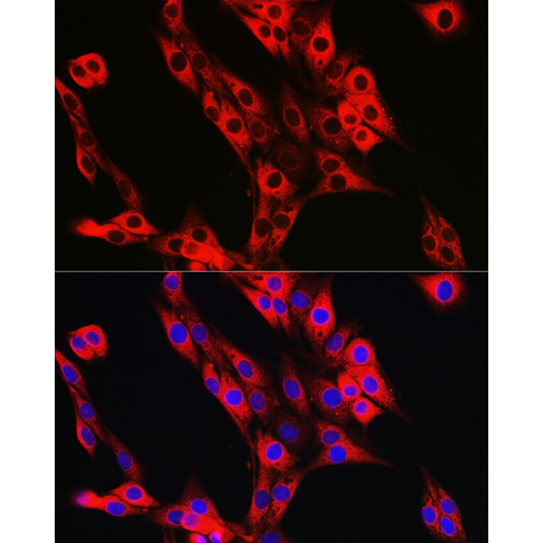 Immunofluorescence - Anti-UFL1 Antibody (A305259) - Antibodies.com