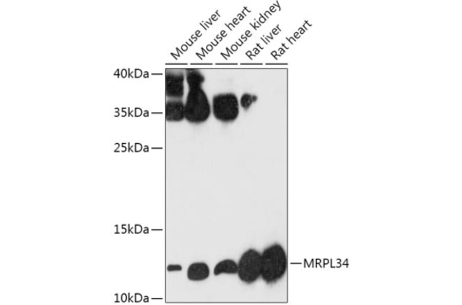 Western Blot - Anti-MRPL34 Antibody (A305260) - Antibodies.com