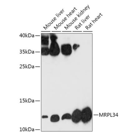 Western Blot - Anti-MRPL34 Antibody (A305260) - Antibodies.com