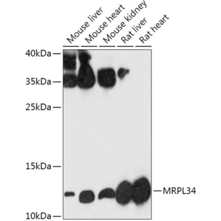 Western Blot - Anti-MRPL34 Antibody (A305260) - Antibodies.com