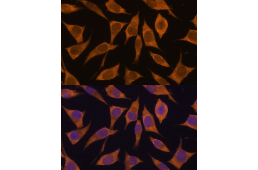 Immunofluorescence - Anti-MRPL34 Antibody (A305260) - Antibodies.com
