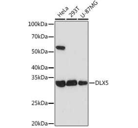 Western Blot - Anti-Dlx5 Antibody [ARC1994] (A305261) - Antibodies.com