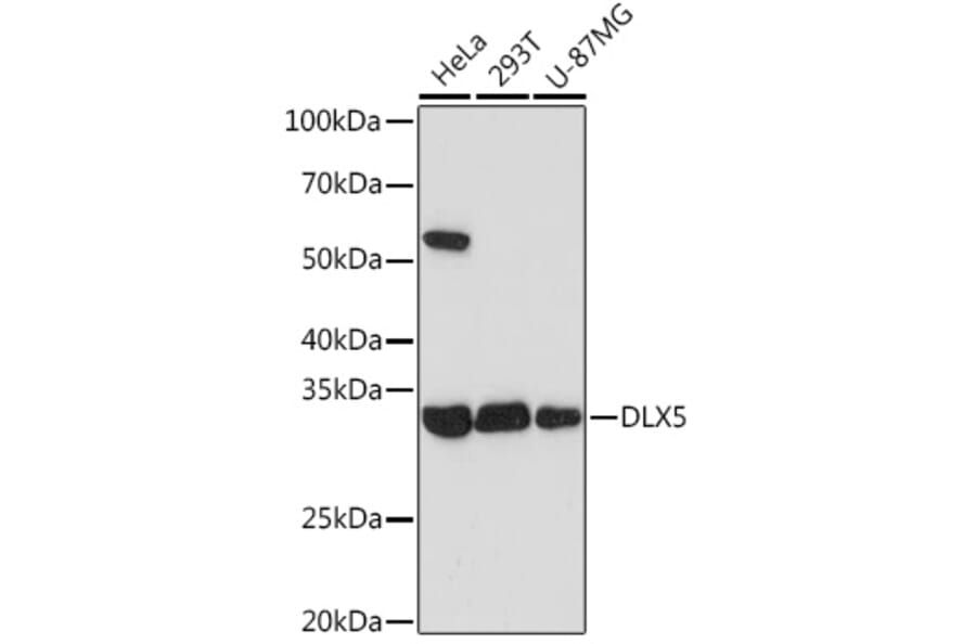 Western Blot - Anti-Dlx5 Antibody [ARC1994] (A305261) - Antibodies.com