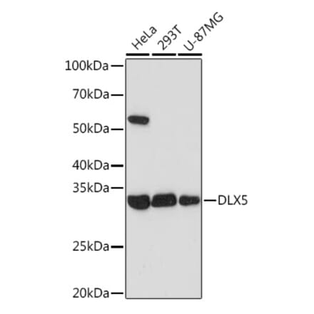 Western Blot - Anti-Dlx5 Antibody [ARC1994] (A305261) - Antibodies.com