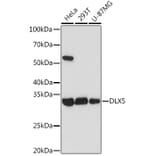 Western Blot - Anti-Dlx5 Antibody [ARC1994] (A305261) - Antibodies.com