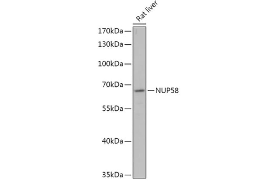 Western Blot - Anti-NUP58 Antibody (A305262) - Antibodies.com