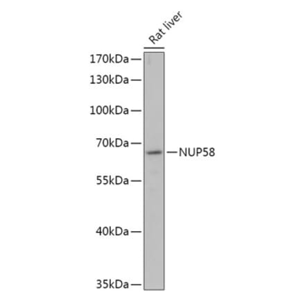 Western Blot - Anti-NUP58 Antibody (A305262) - Antibodies.com