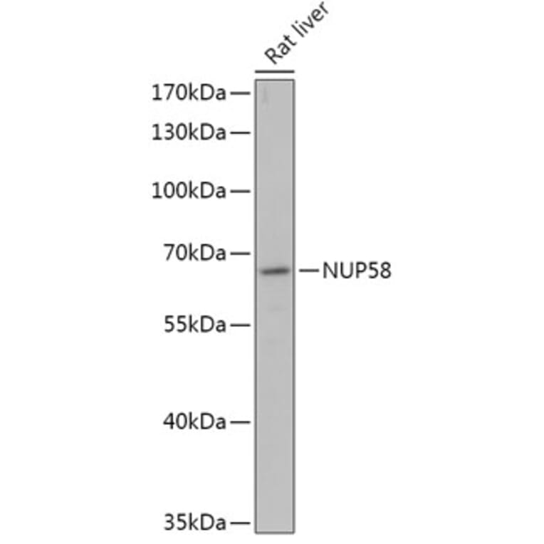 Western Blot - Anti-NUP58 Antibody (A305262) - Antibodies.com