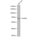 Western Blot - Anti-NUP58 Antibody (A305262) - Antibodies.com
