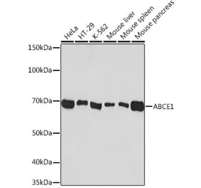 Western Blot - Anti-ABCE1 Antibody [ARC1445] (A305270) - Antibodies.com