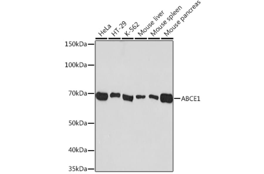 Western Blot - Anti-ABCE1 Antibody [ARC1445] (A305270) - Antibodies.com
