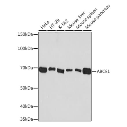 Western Blot - Anti-ABCE1 Antibody [ARC1445] (A305270) - Antibodies.com