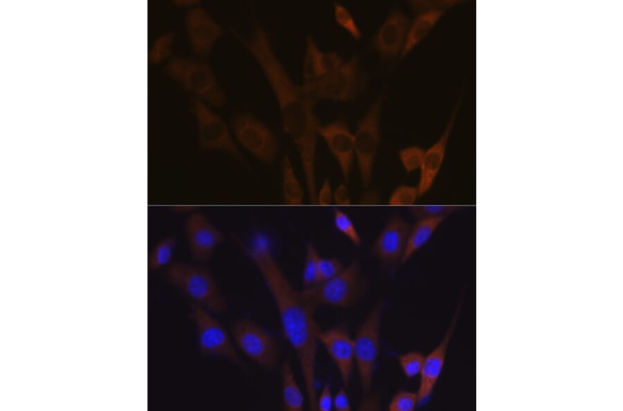 Immunofluorescence - Anti-ABCE1 Antibody [ARC1445] (A305270) - Antibodies.com