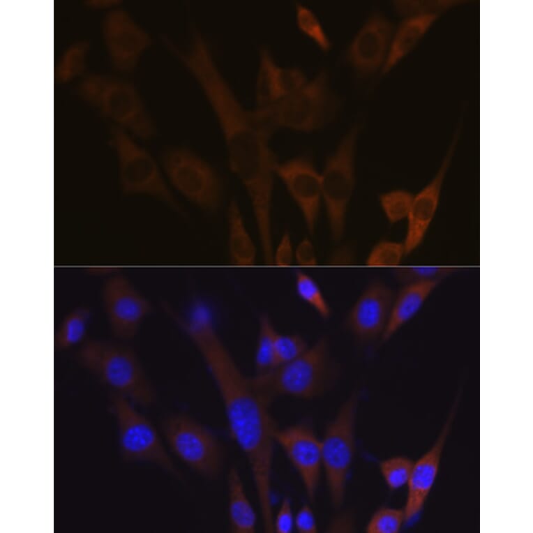 Immunofluorescence - Anti-ABCE1 Antibody [ARC1445] (A305270) - Antibodies.com