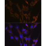 Immunofluorescence - Anti-ABCE1 Antibody [ARC1445] (A305270) - Antibodies.com