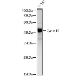 Western Blot - Anti-Cyclin E1 Antibody [ARC51383 + ARC51384] (A305271) - Antibodies.com