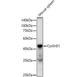 Western Blot - Anti-Cyclin E1 Antibody [ARC51383] (A305272) - Antibodies.com