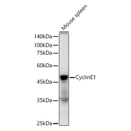 Western Blot - Anti-Cyclin E1 Antibody [ARC51383] (A305272) - Antibodies.com