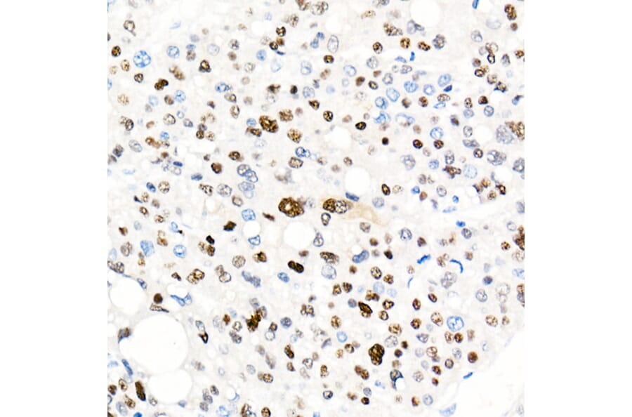 Immunohistochemistry - Anti-Cyclin E1 Antibody [ARC51383] (A305272) - Antibodies.com