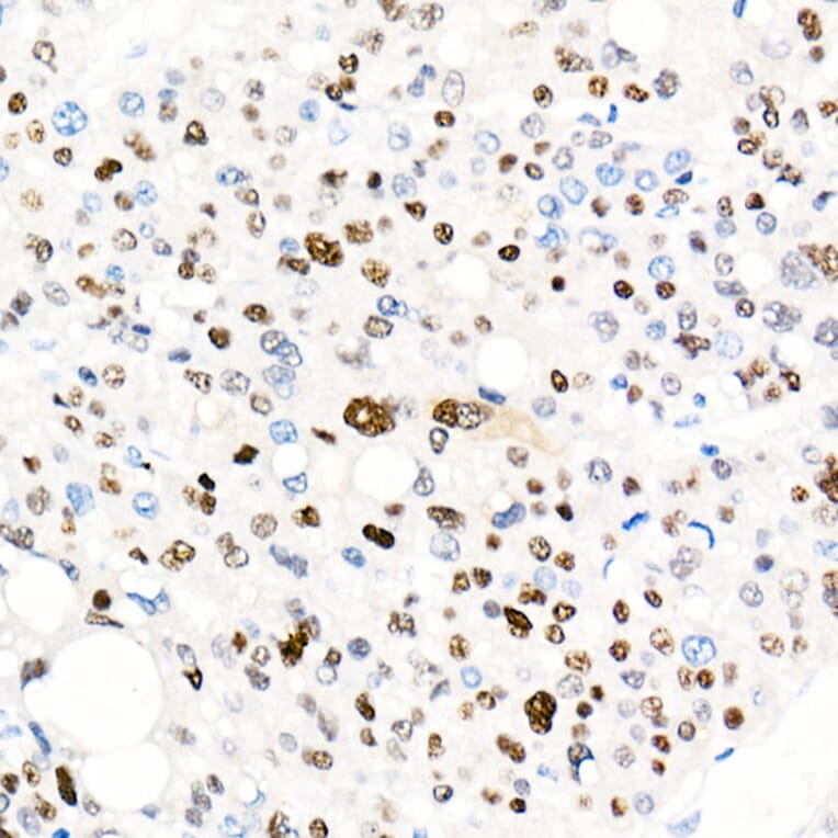 Immunohistochemistry - Anti-Cyclin E1 Antibody [ARC51383] (A305272) - Antibodies.com