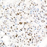 Immunohistochemistry - Anti-Cyclin E1 Antibody [ARC51383] (A305272) - Antibodies.com