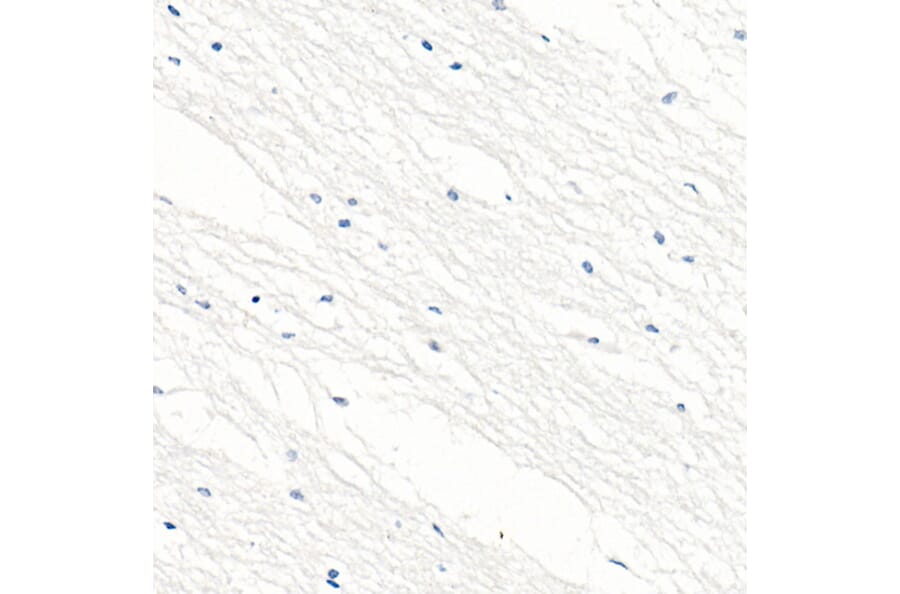 Immunohistochemistry - Anti-Cyclin E1 Antibody [ARC51383] (A305272) - Antibodies.com