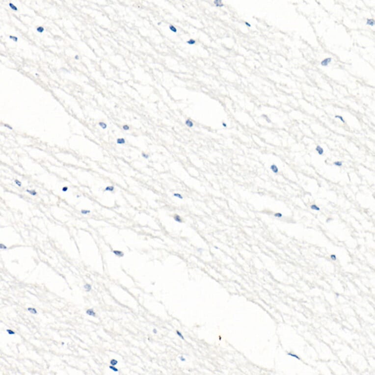 Immunohistochemistry - Anti-Cyclin E1 Antibody [ARC51383] (A305272) - Antibodies.com