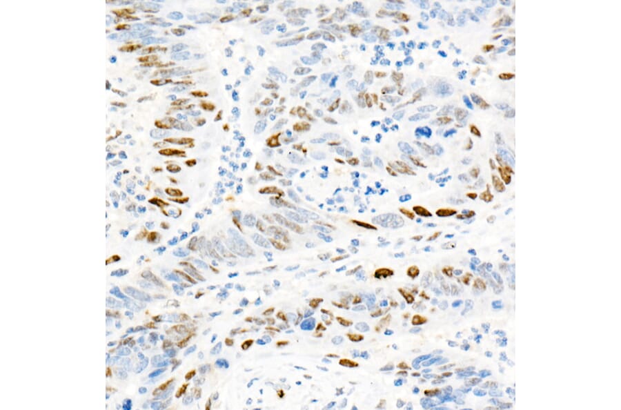 Immunohistochemistry - Anti-Cyclin E1 Antibody [ARC51383] (A305272) - Antibodies.com