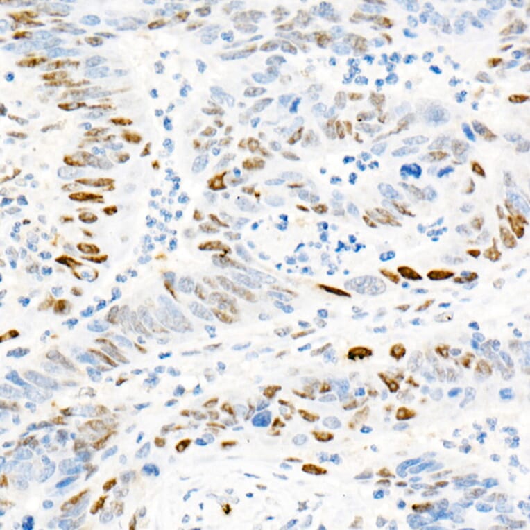 Immunohistochemistry - Anti-Cyclin E1 Antibody [ARC51383] (A305272) - Antibodies.com