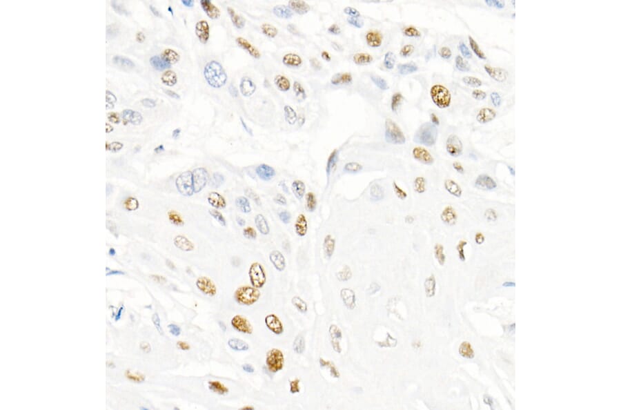 Immunohistochemistry - Anti-Cyclin E1 Antibody [ARC51383] (A305272) - Antibodies.com